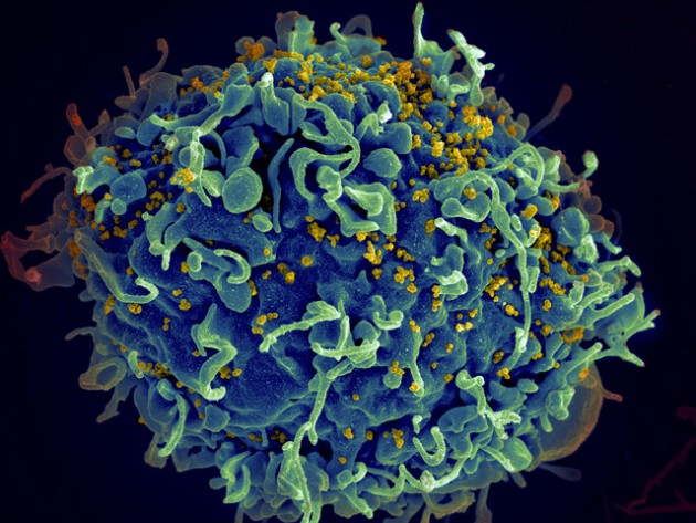 Des virus HIV (en jaune) en train d'infecter une cellule T humaine (Ph. NIH)