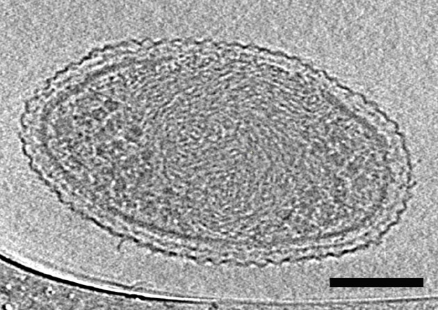 Image inédite d'une mini-bactérie : on y aperçoit le filament replié de son ADN ainsi que des ribosomes (aux deux extrémités). La barre noire représente une longueur de 100 nanomètres. (Credit: Berkeley Lab)