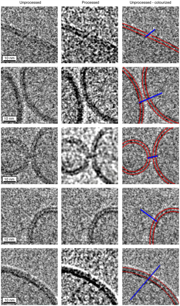Clichés en microscopie électronique d'un nanotube inséré dans la membrane de cellules - images directes et retouchées (Crédit : LLNL)