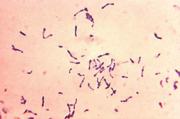 L'agent pathogène de la diphtérie, Corynebacterium diphteriae  - Ph. CDC, domaine public via Wikimedia Commons.