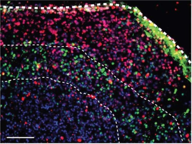 Trois couches de neurones et cellules gliales d'un mini-cerveau produit par les biologistes (Crédit : Sergiu Pasca- M.D- Stanford University)