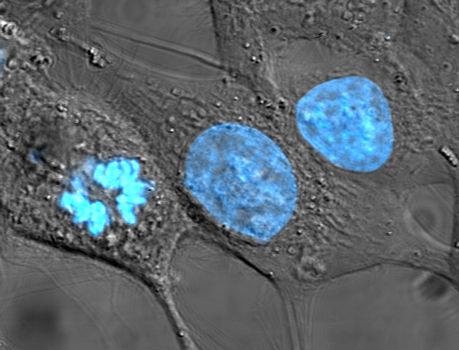 Noyaux cellulaires (en bleu). La cellule de gauche prépare sa duplication  (Ph. domaine public)