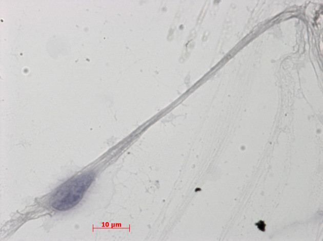 Un des spermatozoïdes humains développés in vitro à partir de spermatogonies prélevées chez un individu. - Ph. ©Kallistem/CNRS / Marie-Hélène PERRARD