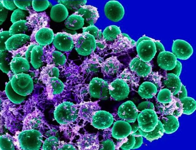 Staphylococcus epidermidis, une bactérie peuplant la peau humaine, était prédominante dans le nuage microbien d'un des participants à l'expérience. - Ph. NIAID / Flickr / CC BY 2.0