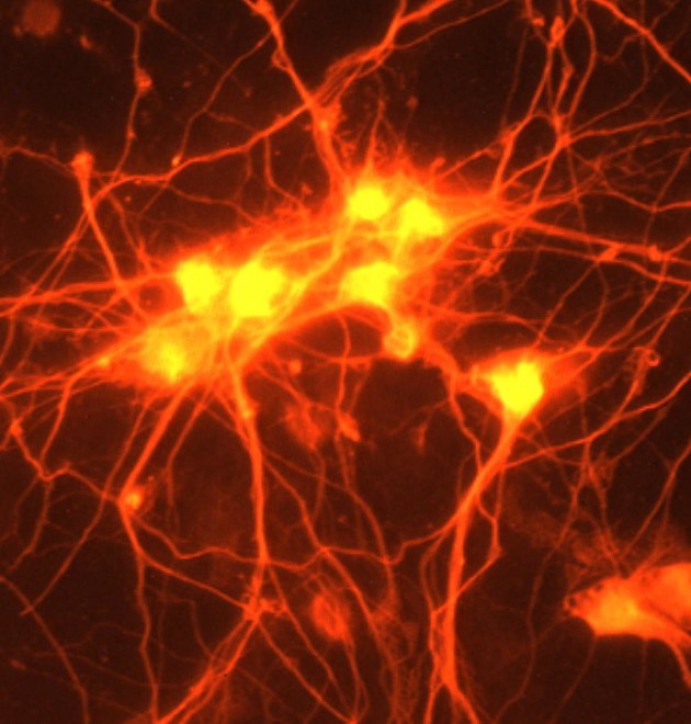 Les cellules des organismes vivants sont chargées d'énergie. Des chercheurs ont réussi à la capter pour alimenter un circuit intégré (ici, cellules du cerveau). Ph. NIH Image Gallery via Flicr CC BY 2.0