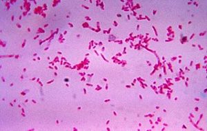 320px-Fusobacterium_novum_01